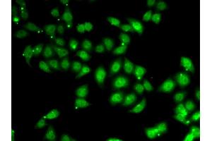 Immunofluorescence analysis of U2OS cells using AFF1 antibody. (AF4 anticorps)