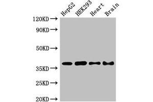 Western Blot Positive WB detected in: HepG2 whole cell lysate, HEK293 whole cell lysate, Mouse heart tissue, Mouse brain tissue All lanes: PNKD antibody at 2. (PNKD anticorps  (AA 78-243))