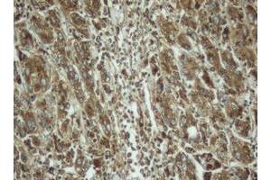 Image no. 3 for anti-Palmitoyl-Protein Thioesterase 1 (PPT1) (AA 100-306) antibody (ABIN1490802)