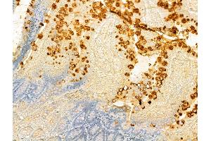 ABIN6265996 and ABIN6273086 at 1/100 staining Rat colon tissue by IHC-P.