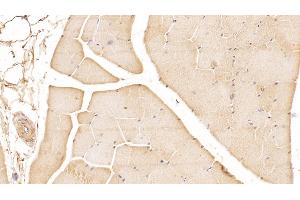 Detection of DUSP3 in Human Skeletal muscle Tissue using Monoclonal Antibody to Dual Specificity Phosphatase 3 (DUSP3)