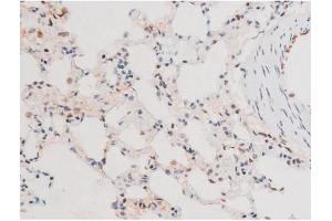 ABIN6267578 at 1/200 staining Rat lung170826 tissue sections by IHC-P.