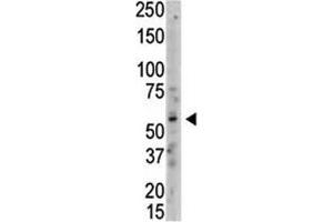 Western blot analysis of PRMT3 antibody and whole HL-60 cell lysate. (PRMT3 anticorps  (AA 460-491))