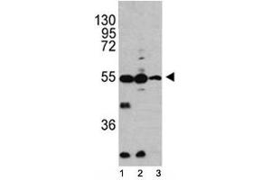 Western blot analysis of Caspase-2 antibody and 1) HL-60, 2) K562, 3) Ramos lysate. (Caspase 2 anticorps  (AA 198-226))