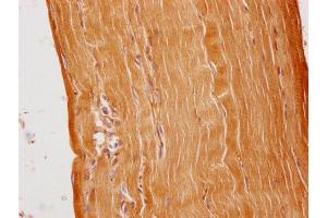 IHC image of ABIN7148324 diluted at 1:100 and staining in paraffin-embedded human skeletal muscle tissue performed on a Leica BondTM system.