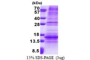 SDS-PAGE (SDS) image for Norrie Disease (Pseudoglioma) (NDP) (AA 25-133) protein (His tag) (ABIN5853193)