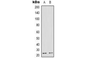 Western blot analysis of TMBIM4 expression in HepG2 (A), human heart (B) whole cell lysates.