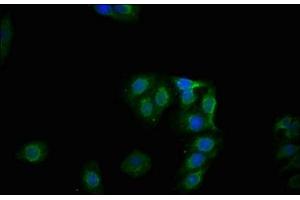 Immunofluorescence staining of HepG2 cells with ABIN7127698 at 1:100,counter-stained with DAPI. (Recombinant Glycogen Synthase 1 anticorps  (pSer641))