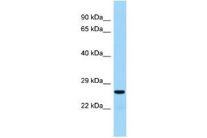 Host:  Rabbit  Target Name:  Akt1s1  Sample Type:  Rat Thymus lysates  Antibody Dilution:  1. (PRAS40 anticorps  (Middle Region))
