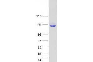 Validation with Western Blot