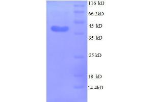 Midkine (Neurite Growth-Promoting Factor 2) (MDK) (AA 21-143), (full length) protein (GST tag)