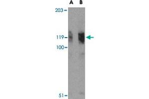 Western blot analysis of FYB in K-562 cell lysate with FYB polyclonal antibody  at (A) 0. (FYB anticorps  (N-Term))