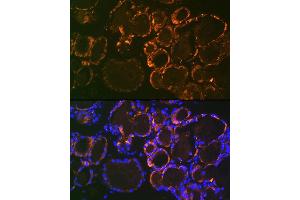 Immunofluorescence analysis of mouse thyroid using Parathyroid Hormone (PTH) (PTH) Rabbit mAb (ABIN7269175) at dilution of 1:100 (40x lens). (PTH anticorps)