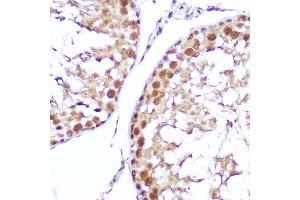 Immunohistochemistry of paraffin-embedded mouse testis using SMOX Rabbit pAb (ABIN6132875, ABIN6148142, ABIN6148143 and ABIN6215369) at dilution of 1:100 (40x lens). (SMOX anticorps  (AA 1-200))