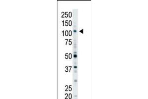 Antibody is used in Western blot to detect EPS15R in Y79 cell lysate. (EPS15 anticorps  (N-Term))