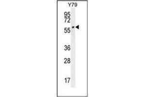 Western blot analysis of LCOR Antibody