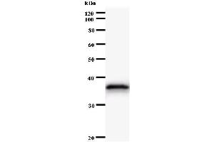 Western Blotting (WB) image for anti-AT Rich Interactive Domain 4A (RBP1-Like) (ARID4A) antibody (ABIN931104) (ARID4A anticorps)