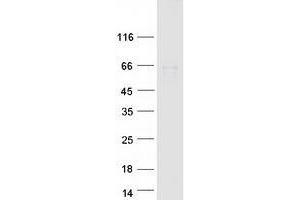Validation with Western Blot