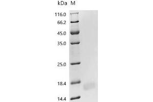 NADH Dehydrogenase (Ubiquinone) 1 alpha Subcomplex, 5, 13kDa (NDUFA5) (AA 2-116), (full length) protein (His tag)