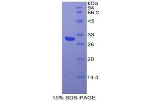 SDS-PAGE (SDS) image for Myosin IA (MYO1A) (AA 781-1043) protein (His tag) (ABIN1878001)