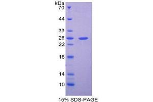 SDS-PAGE (SDS) image for SP100 Nuclear Antigen (SP100) (AA 610-802) protein (His tag) (ABIN2126807)