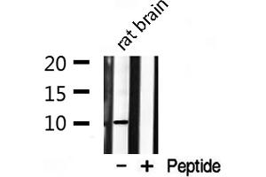 Western blot analysis on rat brain lysate using S100 A1 Antibody