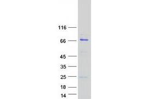 Validation with Western Blot