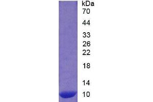SDS-PAGE analysis of Human S100A12 Protein. (S100A12 Protéine)