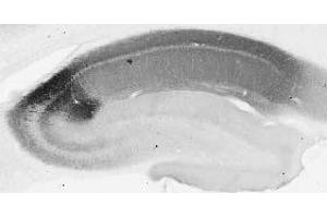 Adult rat hippocampus immunohistochemistry.