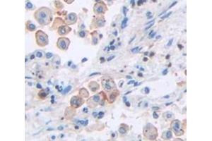 IHC-P analysis of Human Tissue, with DAB staining. (ICAM4 anticorps  (AA 52-234))