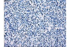 Image no. 1 for anti-Fc Fragment of IgG, Low Affinity IIa, Receptor (CD32) (FCGR2A) antibody (ABIN1497259)