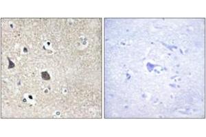 Immunohistochemistry (IHC) image for anti-Midline 1 (MID1) (AA 71-120) antibody (ABIN2889316) (MID1 anticorps  (AA 71-120))