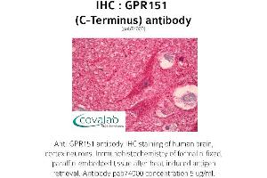 Image no. 1 for anti-G Protein-Coupled Receptor 151 (GPR151) antibody (ABIN1734968)