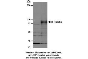 Image no. 2 for anti-Hypoxia Inducible Factor 1, alpha Subunit (Basic Helix-Loop-Helix Transcription Factor) (HIF1A) (AA 432-528) antibody (ABIN363317) (HIF1A anticorps  (AA 432-528))
