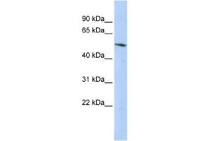WB Suggested Anti-BCL6B Antibody Titration:  0. (BCL6B anticorps  (Middle Region))