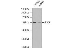 Western blot analysis of extracts of various cell lines, using SGCE antibody (ABIN6132885, ABIN6147703, ABIN6147704 and ABIN6220961) at 1:1000 dilution. (SGCE anticorps  (AA 1-317))