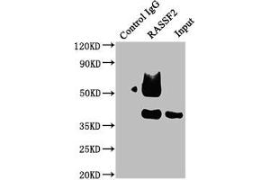 Immunoprecipitating RASSF2 in Raji whole cell lysate Lane 1: Rabbit control IgG instead of ABIN7167126 in Raji whole cell lysate. (RASSF2 anticorps  (AA 69-326))