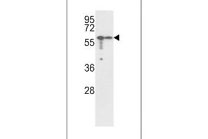 Western blot analysis of Vimentin Antibody (Center) (ABIN389213 and ABIN2839368) in , cell line lysates (35 μg/lane). (Vimentin anticorps  (AA 152-181))