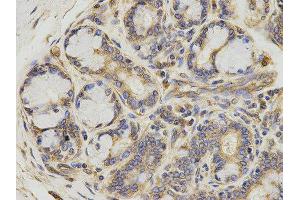 Immunohistochemistry (IHC) image for anti-5-Aminoimidazole-4-Carboxamide Ribonucleotide Formyltransferase/IMP Cyclohydrolase (ATIC) antibody (ABIN1876739) (ATIC anticorps)