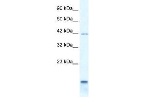 WB Suggested Anti-P2RXL1 Antibody Titration:  0. (P2RX6 anticorps  (N-Term))