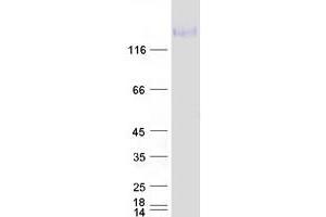 Validation with Western Blot