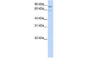 WB Suggested Anti-F13B Antibody Titration:  0. (F13B anticorps  (Middle Region))