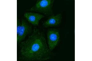 IF analysis of PKM2 using anti-PKM2 antibody (ABIN7603151).