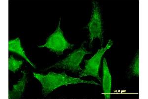 Immunofluorescence of monoclonal antibody to TBCC on HeLa cell.