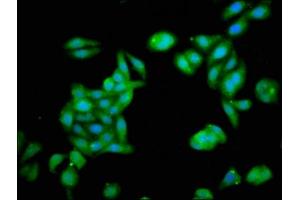 Immunofluorescence staining of HepG2 cells with ABIN7176505 at 1:133, counter-stained with DAPI. (ZNF73 anticorps  (AA 218-286))