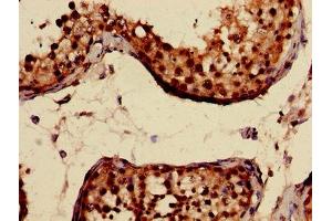 Immunohistochemistry of paraffin-embedded human testis tissue using ABIN7146825 at dilution of 1:100