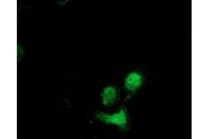 Immunofluorescence (IF) image for anti-Destrin (Actin Depolymerizing Factor) (DSTN) antibody (ABIN1497907)