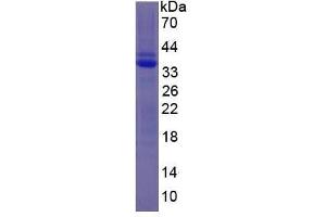 Image no. 2 for Plasminogen (PLG) (AA 100-352) protein (His tag) (ABIN2121900) (PLG Protein (AA 100-352) (His tag))
