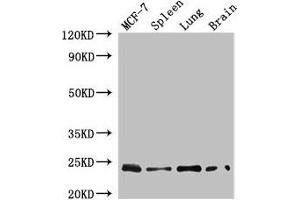 Western Blot Positive WB detected in: MCF-7 whole cell lysate, Mouse spleen tissue, Mouse lung tissue, Mouse brain tissue All lanes: RAB25 antibody at 4 μg/mL Secondary Goat polyclonal to rabbit IgG at 1/50000 dilution Predicted band size: 24 kDa Observed band size: 24 kDa (RAB25 anticorps  (AA 1-210))
