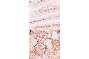 Immunohistochemical staining (Frozen sections) of mouse intestine tissue (A) and rat kidney tissue (B) with ABCB1 polyclonal antibody  under 0. (ABCB1 anticorps  (AA 621-650))